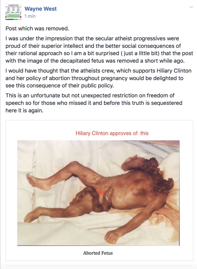hiliary-approves-aborted-fetus